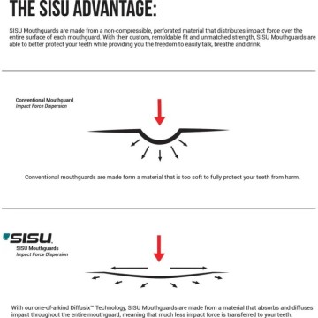 Sisu 3D Mouth Guard (One Size|Charcoal Black)